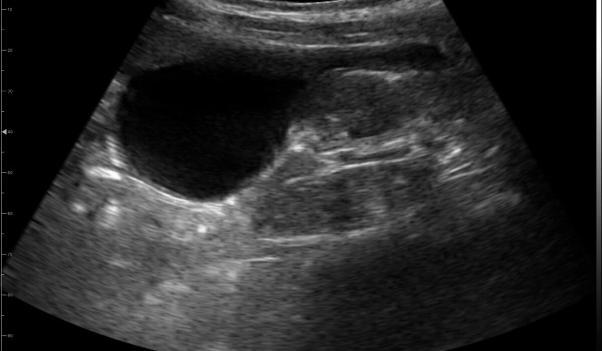 dog_bladder_in_2d_mode