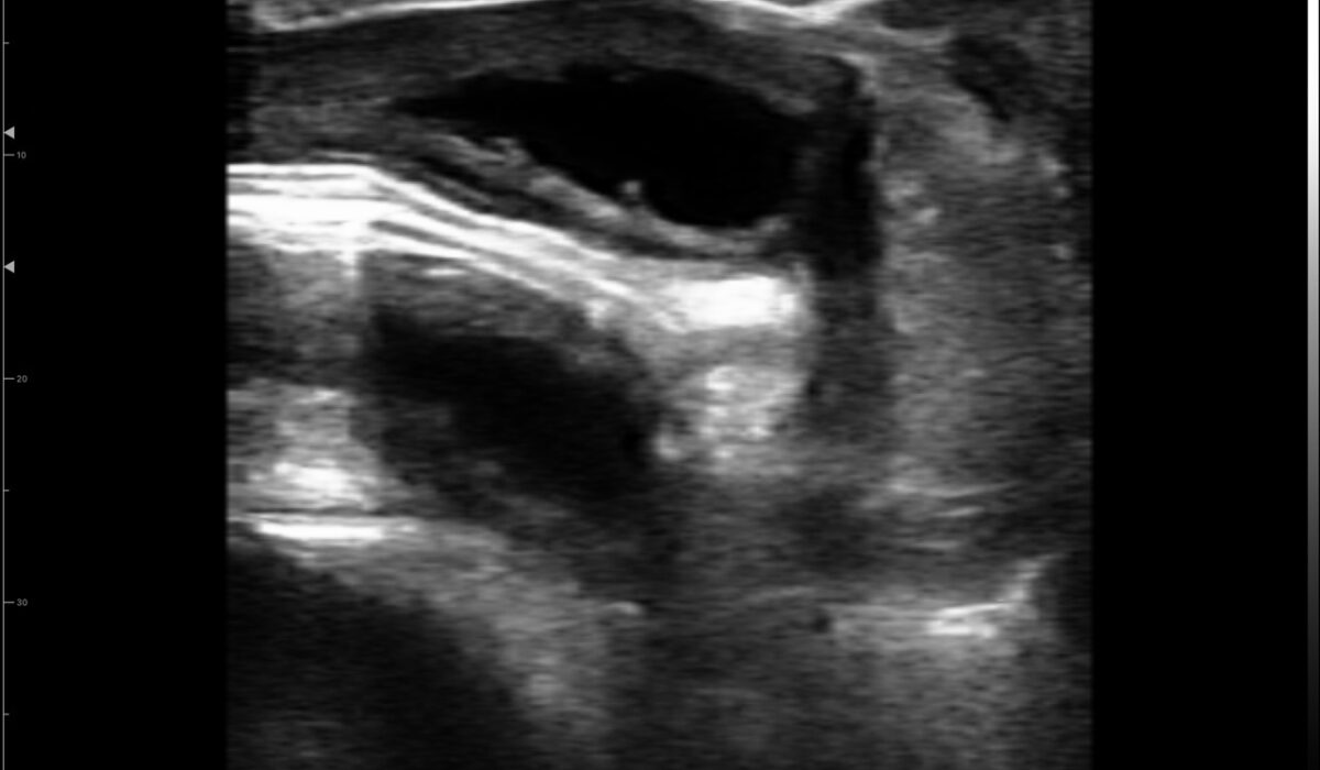 dog_bladder_in_2d_mode