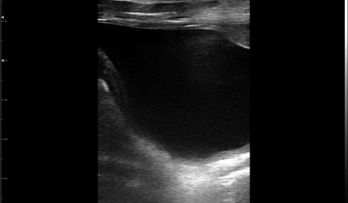 dog_bladder_in_2d_mode