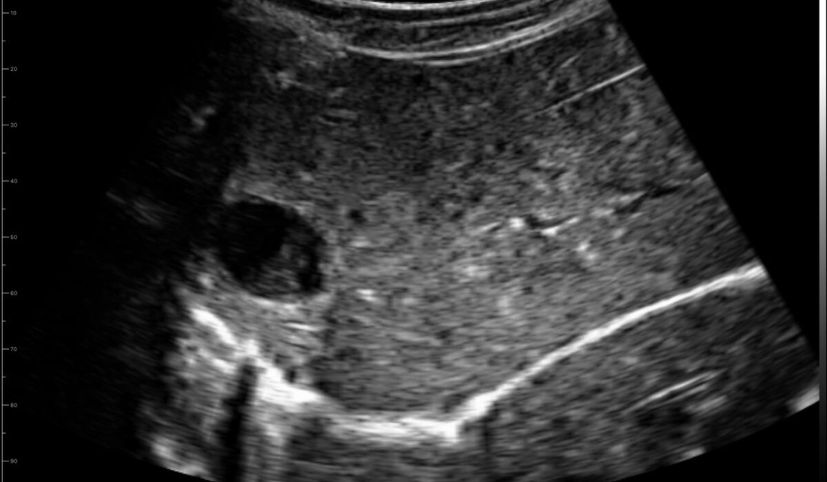 dog_liver_in_2d_mode