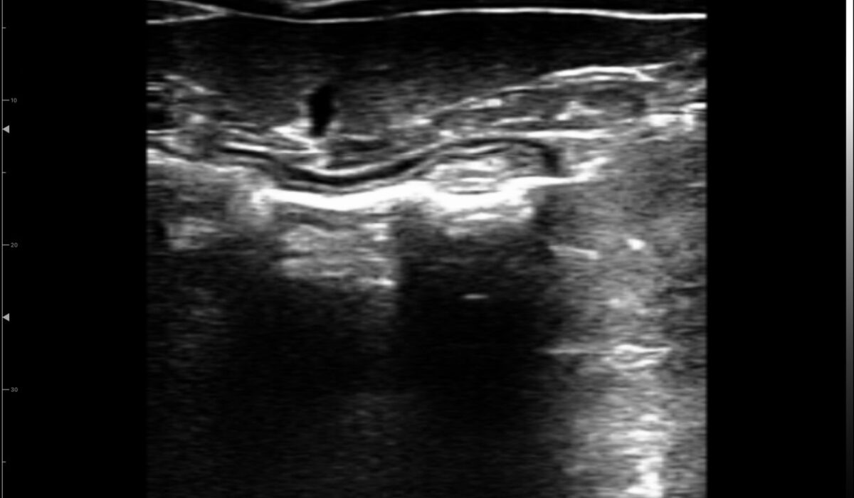 dog_spleen_in_2d_mode