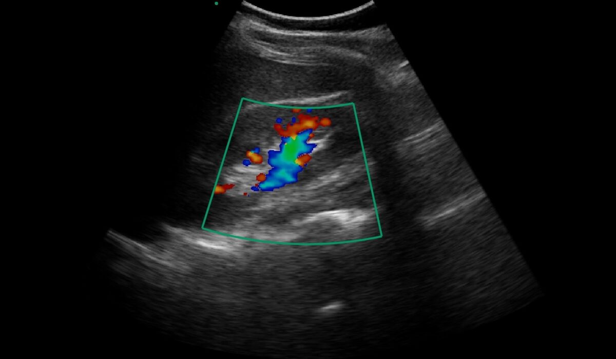 kidney_in_color_mode